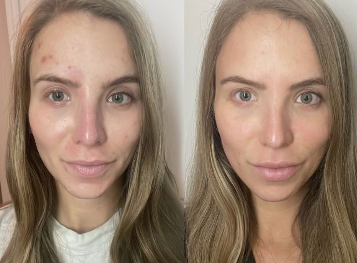 Before & After